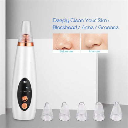 6-in-1 Pore Cleanser &amp; Nano Steamer Set
